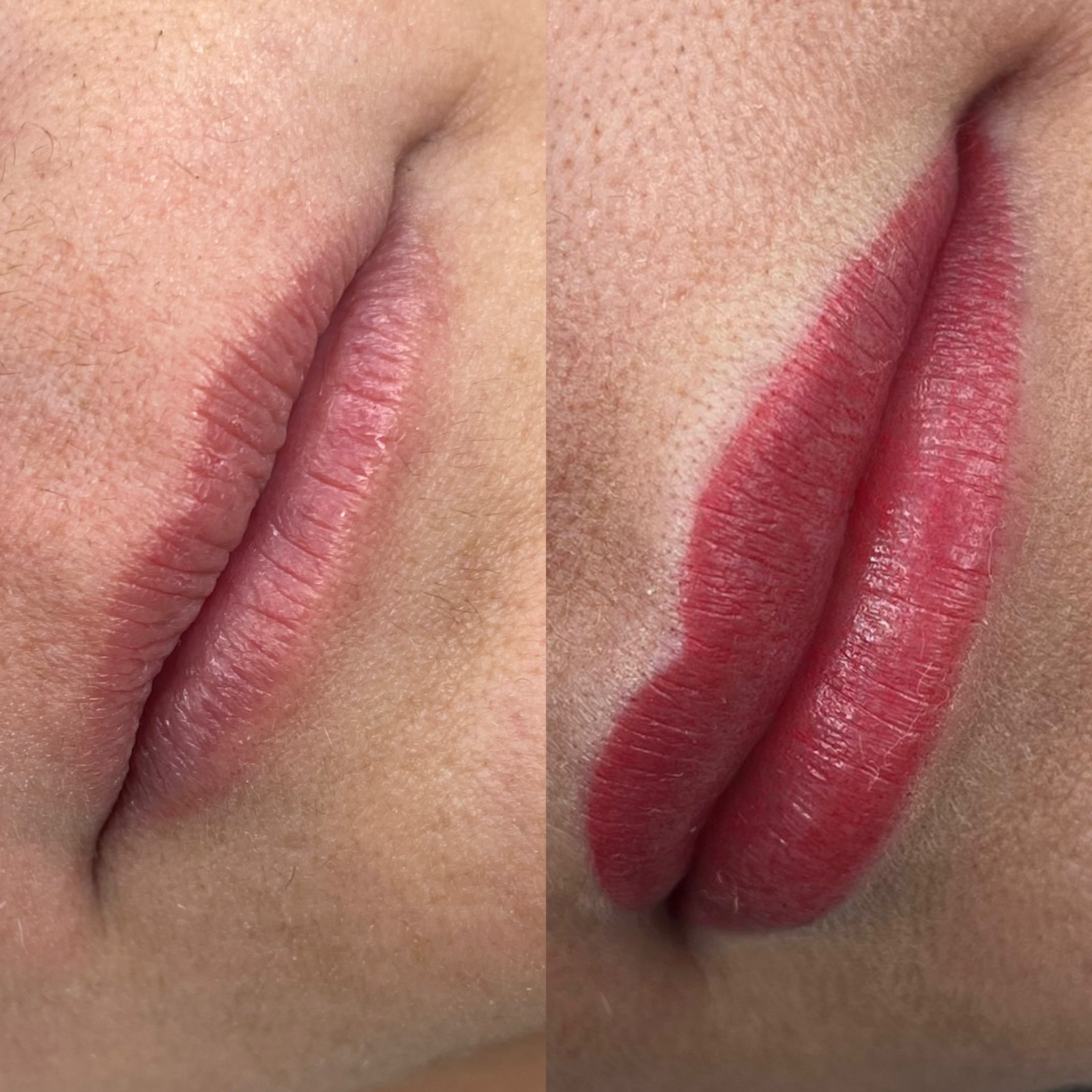 Antes y después de una micropigmentación de labios